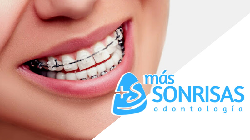 Más Sonrisas Odontología El Tigre