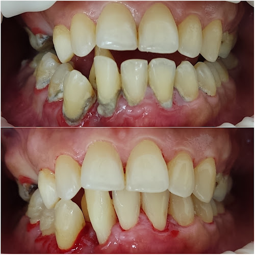 Centro de Odontología Especializada O'dent