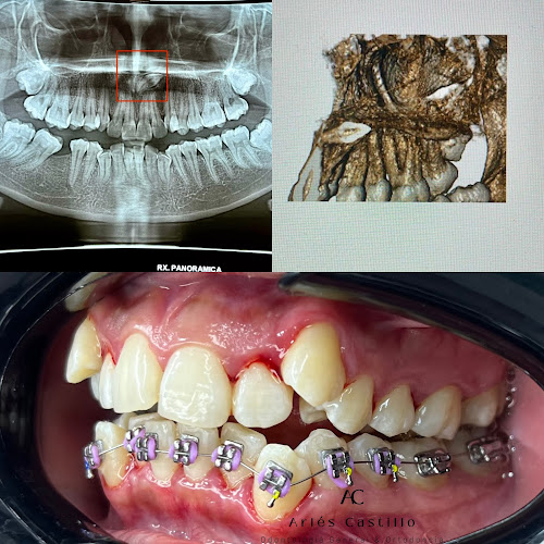 Consultorio Odontologico Estetica Dental y Ortodoncia CESORT